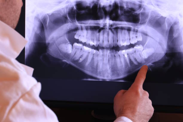 Best Emergency Dental Care for Broken or Chipped Teeth in Walnut Ridge, AR